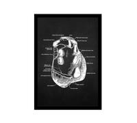Obra de arte de anatomía humana, imagen médica de esqueleto muscular, póster vintage, lienzo nórdico, pintura educativa, decoración de pared (SKU11,12 x 18 pulgadas = (30 x 45 cm), marco de fotos