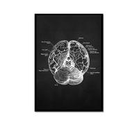 Obra de arte de anatomía humana, imagen médica de esqueleto muscular, póster vintage, lienzo nórdico, pintura educativa, decoración de pared (SKU7,16 x 24 pulgadas = (40 x 60 cm), marco de metal negro