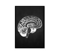 Obra de arte de anatomía humana, imagen médica de esqueleto muscular, póster vintage, lienzo nórdico, pintura educativa, decoración de pared (SKU10,12 x 16 pulgadas = (30 x 40 cm), marco de metal