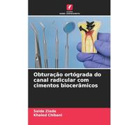 Obturação ortógrada do canal radicular com cimentos biocerâmicos