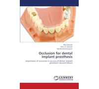 Occlusion for dental implant prosthesis: Importance of occlusion in success of dental implant prosthesis Second Edition