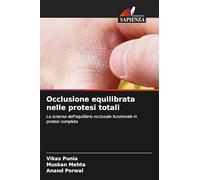 Occlusione equilibrata nelle protesi totali: La scienza dell'equilibrio occlusale funzionale in protesi completa