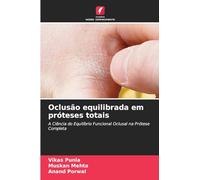 Oclusão equilibrada em próteses totais: A Ciência do Equilíbrio Funcional Oclusal na Prótese Completa