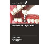 Oclusión en implantes
