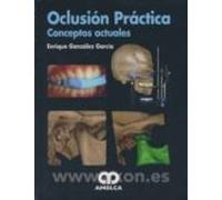 oclusion practica: conceptos actuales