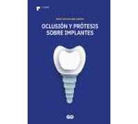 Oclusión y Prótesis sobre Implantes (SIN COLECCION)