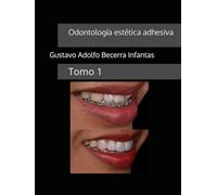 Odontología estética adhesiva: Tomo 1