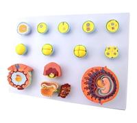 oiakus Proceso De Desarrollo Fetal Y Modelo Anatómico Médico, con Identificador Digital, Compuesto por 13 Componentes, para Enseñar La Comunicación Médico-Paciente, Explicar Y Demostrar