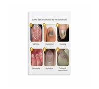 Onychology Reference Chart Poster Nail Technician Office Decor