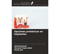 Opciones protésicas en implantes