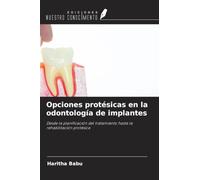 Opciones protésicas en la odontología de implantes: Desde la planificación del tratamiento hasta la rehabilitación protésica