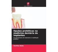 Opções protéticas na medicina dentária de implantes: Do planeamento do tratamento à reabilitação protética