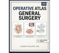 OPERATIVE ATLAS OF GENERAL SURGERY: llustrated Techniques in Open, Laparoscopic, and Robotic Procedures