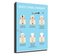 Oral Health Infographic Root Canal Poster Wall-Art Decor(Framed,12x18inch(30x45cm))