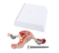 Orivin Modelo anatómico del sistema reproductor femenino, modelo de enseñanza de la estructura uterino-ovárica, anatomía científica desmontable.