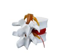 Orivin Modelo anatómico vertebral lumbar - Modelo de demostración de hernia discal lumbar humana 1.5X (blanco)