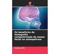 Os benefícios da tomografia computorizada da massa facial na osteopetrose