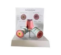 OSPSHPG Modelo anatómico del asma Humano, Modelo del Sistema respiratorio y bronquial, con Tarjeta explicativa, para el Estudio, la exposición y la enseñanza de los Estudiantes