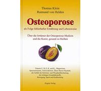 Osteoporose als Folge fehlerhafter Ernährung und Lebensweise: Über die Irrtümer der Osteoporose-Medizin und die Kunst, gesund zu bleiben