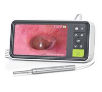 Otoscopio digital 1080P con giroscopio, cámara AnyScope de 3.9 mm con 6 luces, pantalla de 4.5 pulgadas, herramienta de eliminación de cera de oído, tarjeta de 32 GB, soporta captura de fotos y