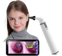 Otoscopio inalámbrico con cámara de oído y doble vista, 3,9 mm, 720 pHD, wifi, con 6 luces LED para niños