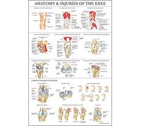 Palace Learning Póster laminado de anatomía y lesiones de la rodilla, gráfico anatómico de la articulación de la rodilla, 45,7 x 61 cm