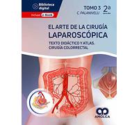 PALANIVELU EL ARTE DE LA CIRUGIA LAPAROSCOPICA GASTROESOF