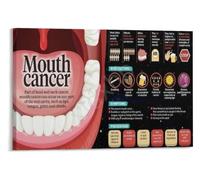 Palate and Floor Inspection Poster Dental Patient Education Art