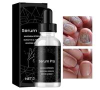 Palaufr Reparación de Uñas Agrietadas,Gel Fortalecedor Hidratante Natural De 30ml,Para El Crecimiento De Uñas - Cuidado De Manicura Para De Manos Pies Y Dedos