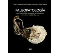 Paleopatología en la colección del laboratorio de Antropología de la Universidad de Granada (Universidad de Granada. Historia y Patrimonio)