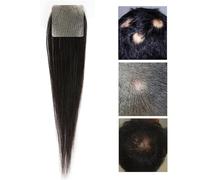 Parche De Cabello Humano Real Para Reemplazo De áRea Local,Peluca Invisible Para Frente Patillas Flequillo Sistemas De ExtensióN De Cabello Para Mujeres Y Hombres(Square,2.5x2.5cm)