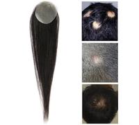 Parche De Cabello Humano Real Para Reemplazo De áRea Local,Peluca Invisible Para Frente Patillas Flequillo Sistemas De ExtensióN De Cabello Para Mujeres Y Hombres(Circular,4x4cm)