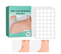 Parches para quitar marca de nacimiento - 120 uds. Pegatinas faciales - Parche de eliminación de marca de nacimiento de piel | Para el camino Inicio Pies Piernas Brazos Manos Hombros Espalda Cuello