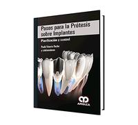 PASOS PARA LA PROTESIS SOBRE IMPLANTES