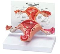 Pathological Uterus Ovary Anatomical Model Anatomy Cross Section Study Tool