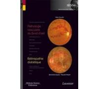Pathologie Vasculaire Du Fond Doeil / Rétinopathie Diabétique (ebook)