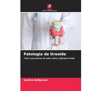 Patologia da tireoide: Tudo o que precisa de saber sobre a glândula tiroide