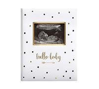Pearhead Hello Baby - Libro de recuerdos para bebé, diario de hitos, regalo para nueva mamá, bebé recién nacido, recuerdo pensado para bautizo o bautizo, lunares blancos y negros, versión en inglés