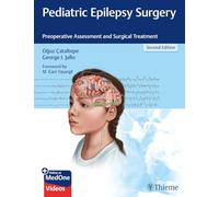 Cirugía de la epilepsia pediátrica – Evaluación preoperatoria y tratamiento quirúrgico