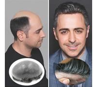 Peluca de moño para hombre Sistema de cabello Base transparente de piel fina, frente Invisible, 0,06-0,08mm de espesor, reemplazo de cabello for peluquín for hombres Peluca para hombres(3#dark brown w