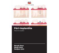 Péri-implantite: Percer le mystère