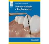 Periodontologia E Implantologia