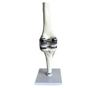 Pesfehhy Modelo de Simulación de Articulación de Rodilla, Cirugía de Reemplazo, Modelo de Cirugía de Ligamento de Menisco, Cartílago, Articulación de Rodilla Artificial