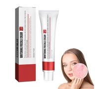 Pigment Spot Cream, Anti Pimple Cream Anti-Acne Anti-Pigmentation Cream Brightening Freckle Cream For Peckles Acne Freckle Removal Cream, Whitening Peckles Cream For Dark Spot Remover, Acne Removal