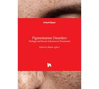 Pigmentation Disorders - Etiology and Recent Advances in Treatments