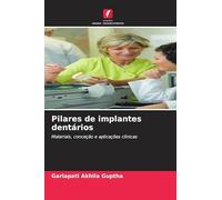 Pilares de implantes dentários: Materiais, conceção e aplicações clínicas
