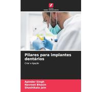 Pilares para implantes dentários: Criar a ligação