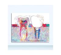 Pintura de arte pared, cartel higienista medicina, decoración clínica acuarela dientes, imagen Dental, impresión lienzo implante dental, dentista(1,A4 21x30cm No Frame)