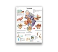 Pintura en lienzo de arte del sistema muscular anatomía humana, imagen corporal y decoración carteles educación medicina familiar, sin marco(7,60X90cm Unframed)
