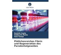 Plättchenreiches Fibrin und Regeneration des Parodontalgewebes